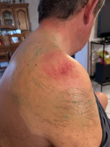 Eric touché mais pas coulé 1.jpg