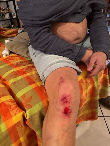 Eric touché mais pas coulé 2.jpg