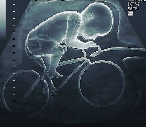 Échographie de Mathieu Van der Poel, fils d'Adrie Van der Poel et petit-fils de Raymond Poulidor..jpg